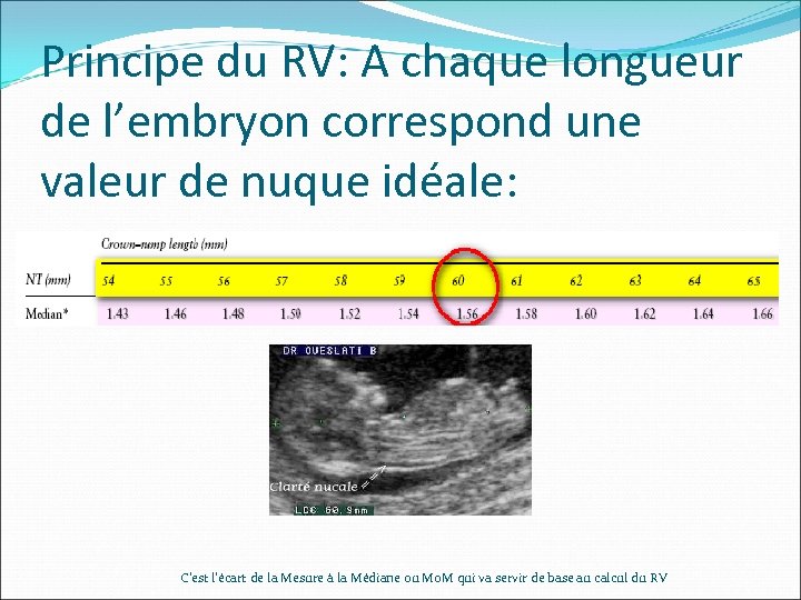 Principe du RV: A chaque longueur de l’embryon correspond une valeur de nuque idéale: