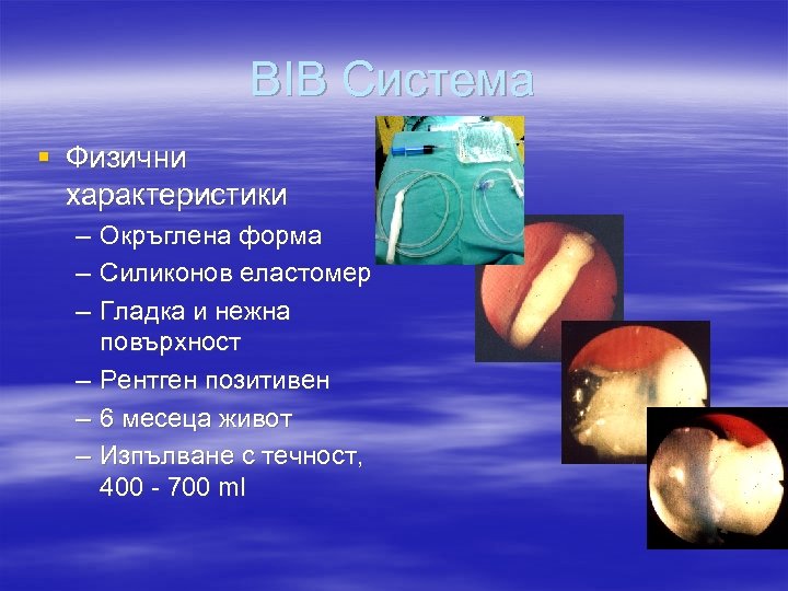 BIB Система § Физични характеристики – – – Окръглена форма Силиконов еластомер Гладка и