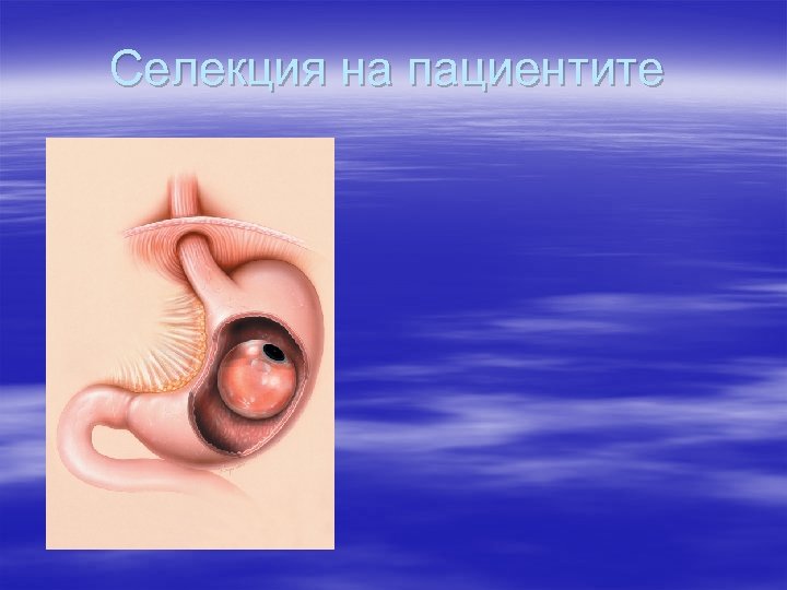 Селекция на пациентите 