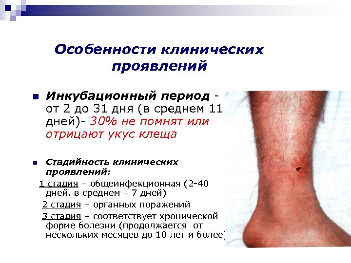 Особенности клинических проявлений n n Инкубационный период от 2 до 31 дня (в среднем
