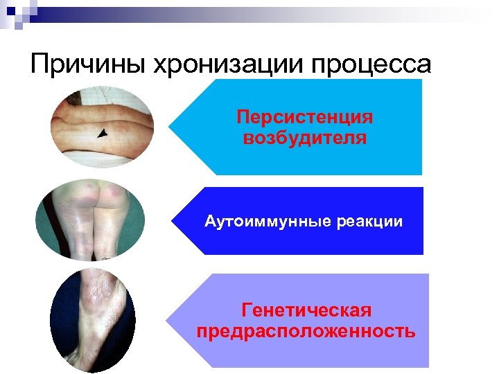 Трансмиссивные инфекции презентация