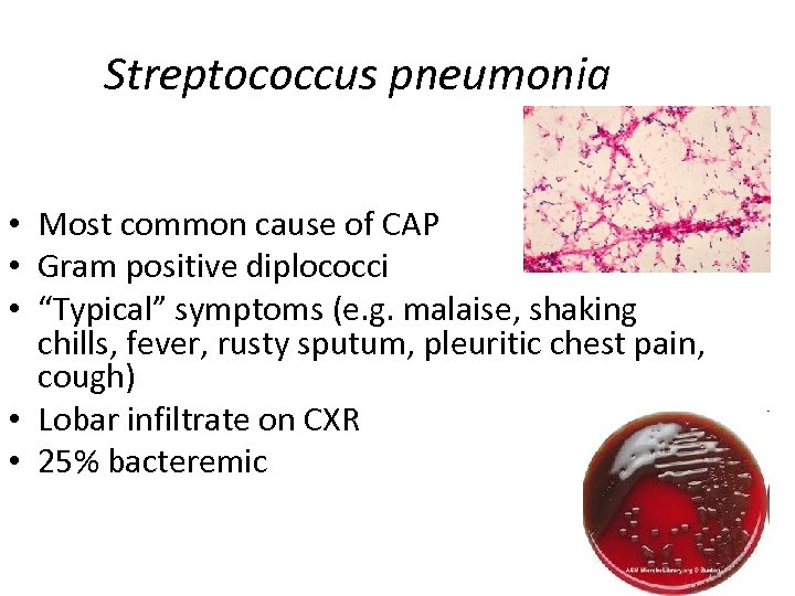 Streptococcus pneumonia • Most common cause of CAP • Gram positive diplococci • “Typical”