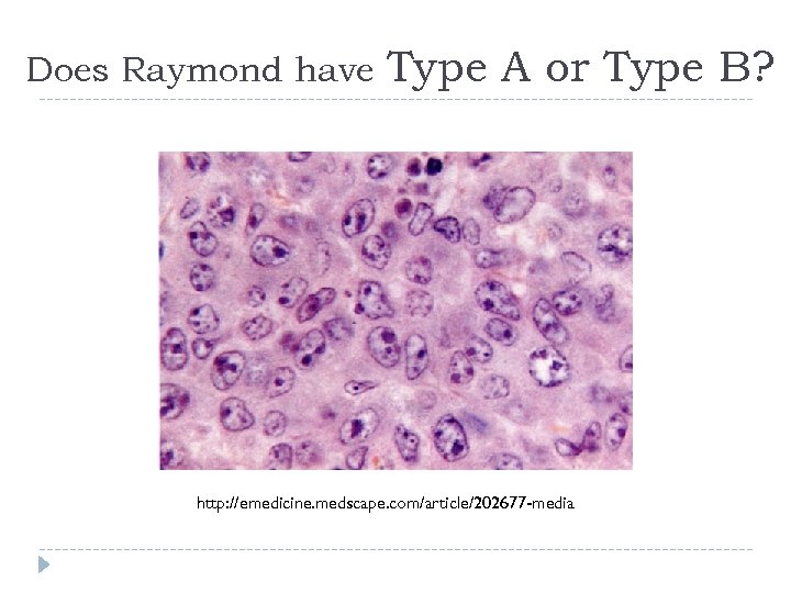 Does Raymond have Type A or Type B? http: //emedicine. medscape. com/article/202677 -media 