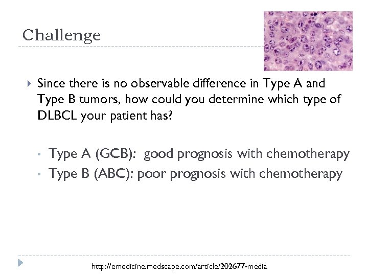 Challenge Since there is no observable difference in Type A and Type B tumors,