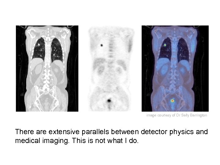 image courtesy of Dr Sally Barrington There are extensive parallels between detector physics and