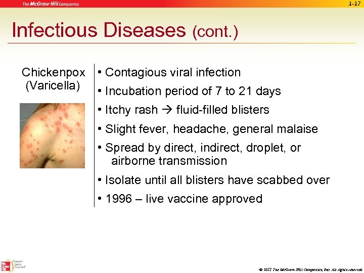 1 -17 Infectious Diseases (cont. ) Chickenpox (Varicella) • Contagious viral infection • Incubation