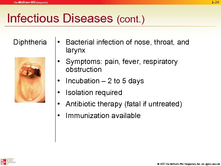 1 -20 Infectious Diseases (cont. ) Diphtheria • Bacterial infection of nose, throat, and