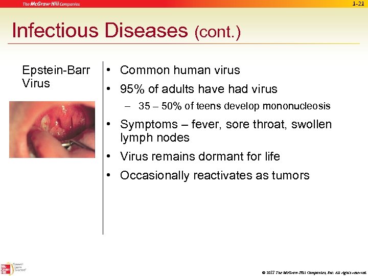 1 -21 Infectious Diseases (cont. ) Epstein-Barr Virus • Common human virus • 95%