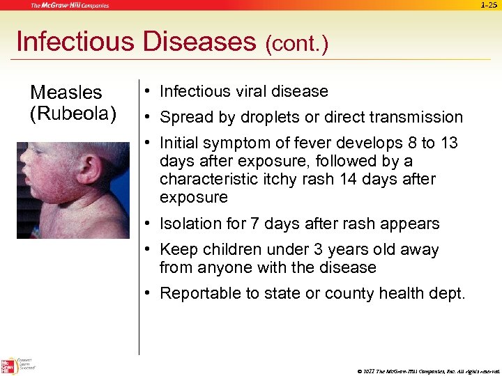1 -25 Infectious Diseases (cont. ) Measles (Rubeola) • Infectious viral disease • Spread
