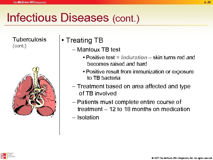 1 -36 Infectious Diseases (cont. ) Tuberculosis (cont. ) • Treating TB – Mantoux