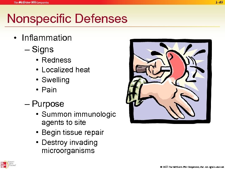 1 -49 Nonspecific Defenses • Inflammation – Signs • • Redness Localized heat Swelling