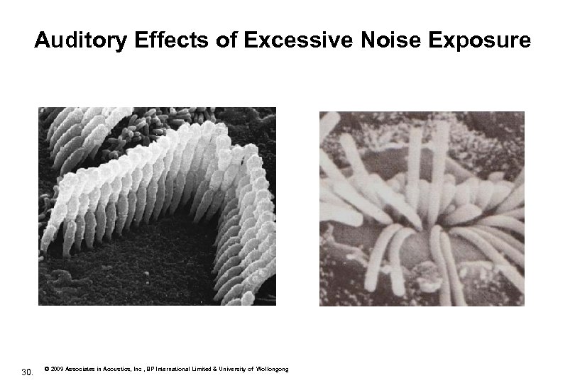 Auditory Effects of Excessive Noise Exposure 30. © 2009 Associates in Acoustics, Inc ,