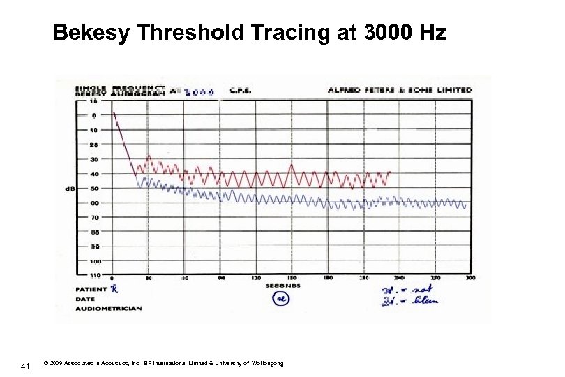 Bekesy Threshold Tracing at 3000 Hz 41. © 2009 Associates in Acoustics, Inc ,