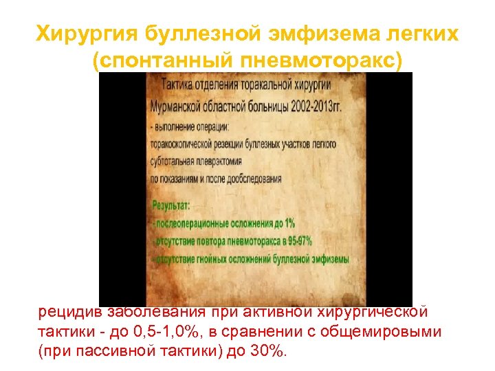 Хирургия буллезной эмфизема легких (спонтанный пневмоторакс) рецидив заболевания при активной хирургической тактики - до