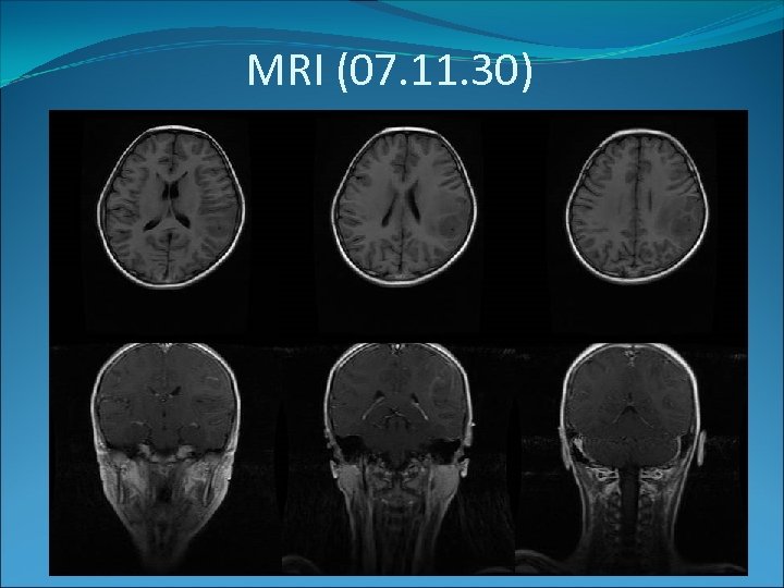 MRI (07. 11. 30) 