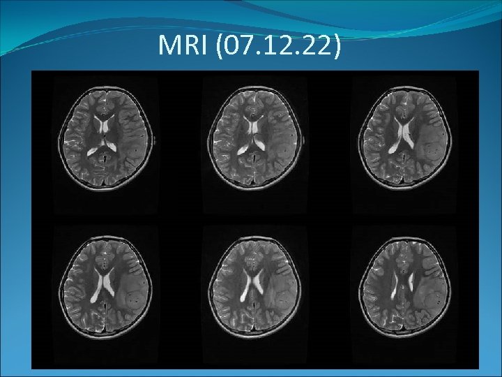 MRI (07. 12. 22) 