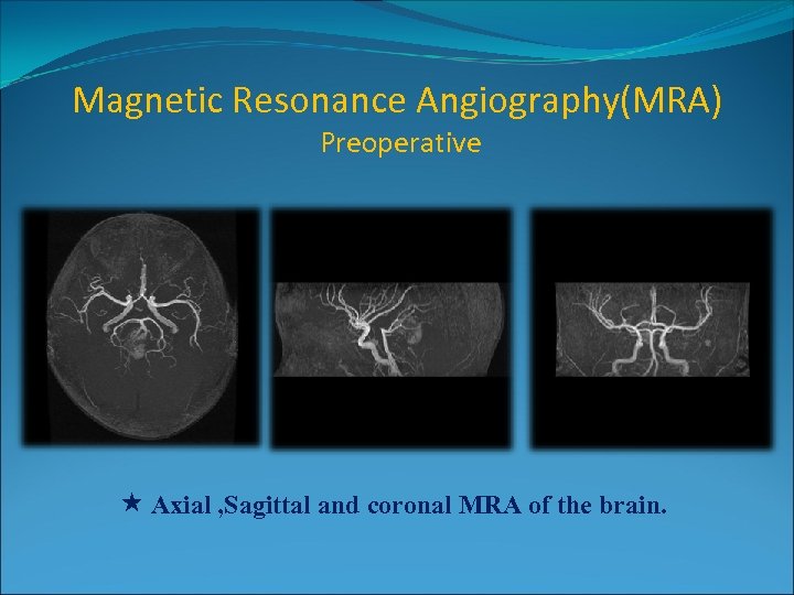 Magnetic Resonance Angiography(MRA) Preoperative Axial , Sagittal and coronal MRA of the brain. 