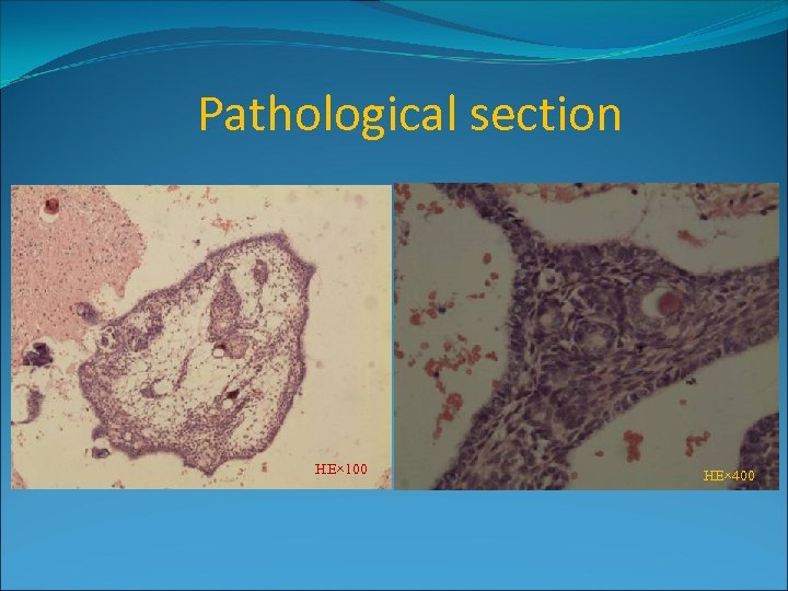 Pathological section HE× 100 HE× 400 