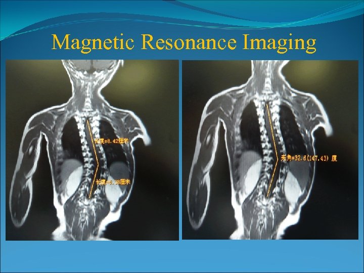 Magnetic Resonance Imaging 