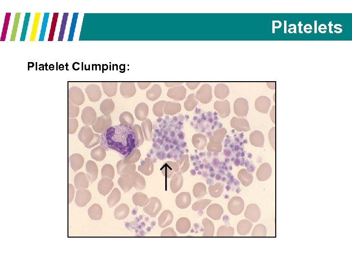 Platelets Platelet Clumping: 