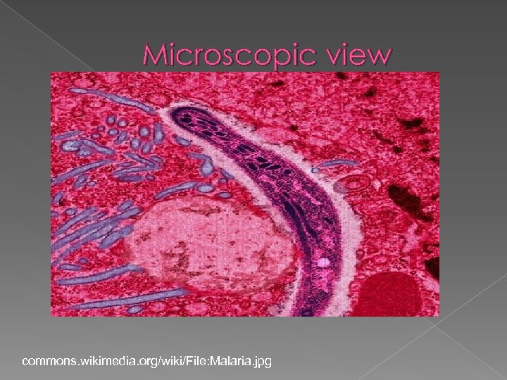 Microscopic view commons. wikimedia. org/wiki/File: Malaria. jpg 