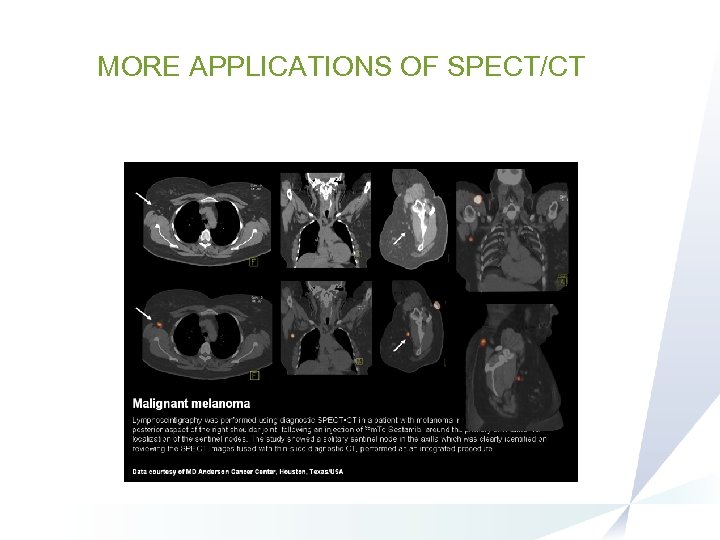 MORE APPLICATIONS OF SPECT/CT 