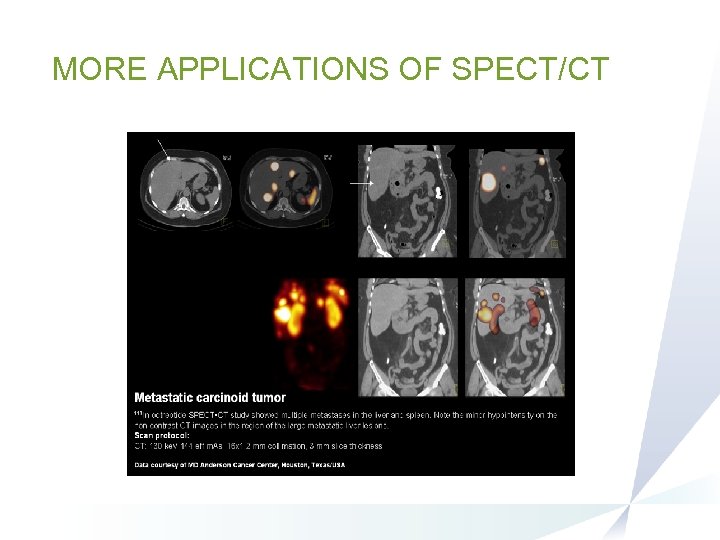 SPECT CT IMAGING Benefits to Clinical Nuclear Medicine