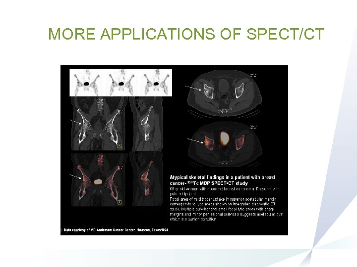 MORE APPLICATIONS OF SPECT/CT 