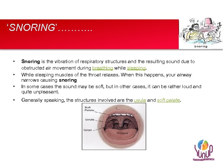 ‘SNORING’………. . • • Snoring is the vibration of respiratory structures and the resulting