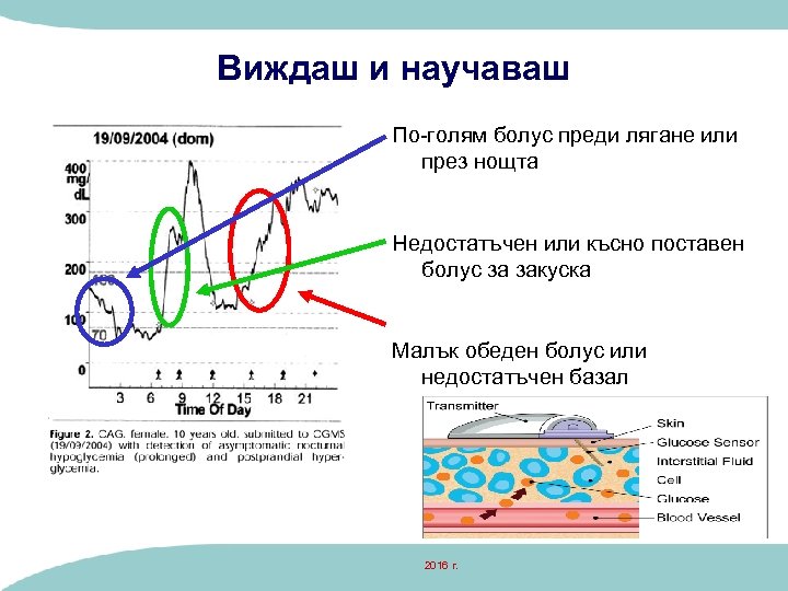 Виждаш и научаваш По-голям болус преди лягане или през нощта Недостатъчен или късно поставен