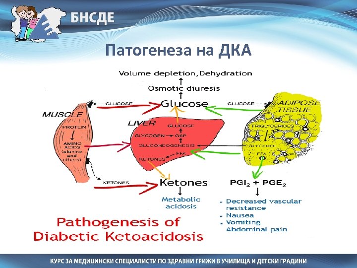 Патогенеза на ДКА 