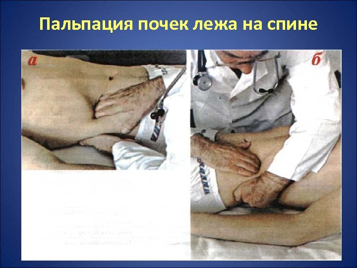 Пальпация почек лежа на спине 
