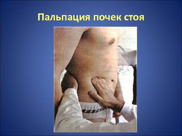 Пальпация почек стоя 