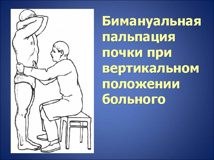 Бимануальная пальпация почки при вертикальном положении больного 