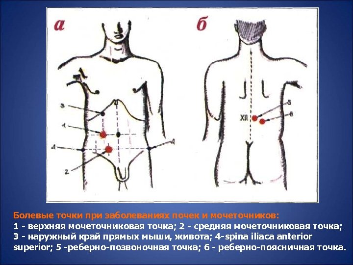 Болевые точки при заболеваниях почек и мочеточников: 1 - верхняя мочеточниковая точка; 2 -