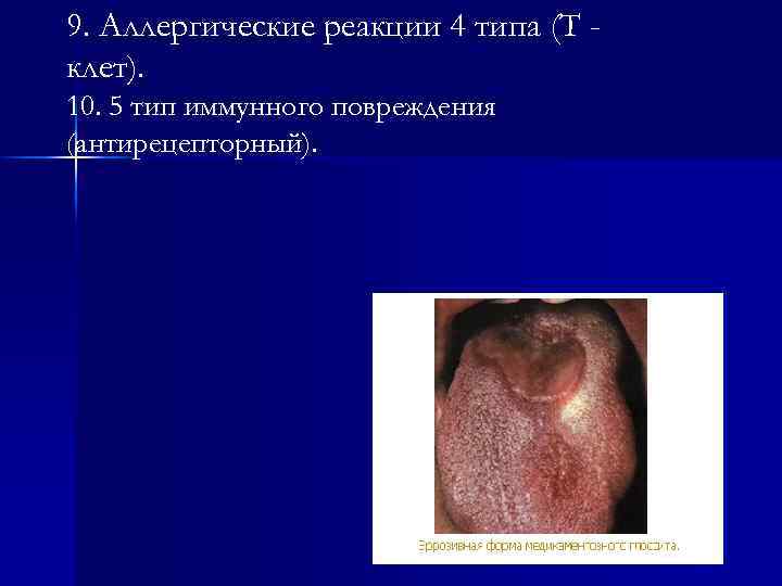 9. Аллергические реакции 4 типа (Т клет). 10. 5 тип иммунного повреждения (антирецепторный). 