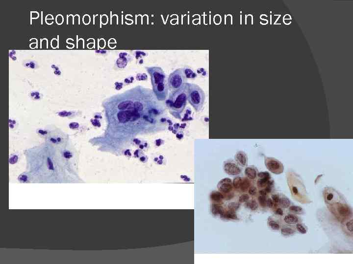 Pleomorphism: variation in size and shape 