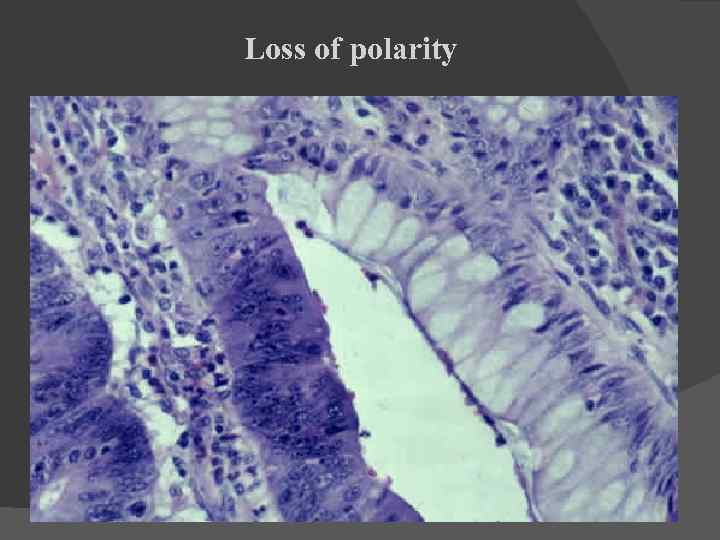 Loss of polarity 