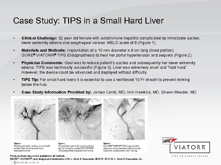 Case Study: TIPS in a Small Hard Liver • Clinical Challenge: 52 year old