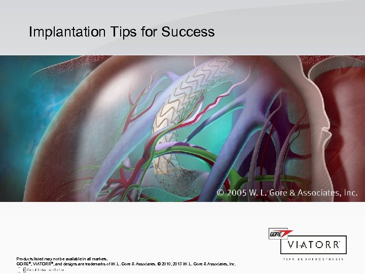 Implantation Tips for Success Products listed may not be available in all markets. GORE®,