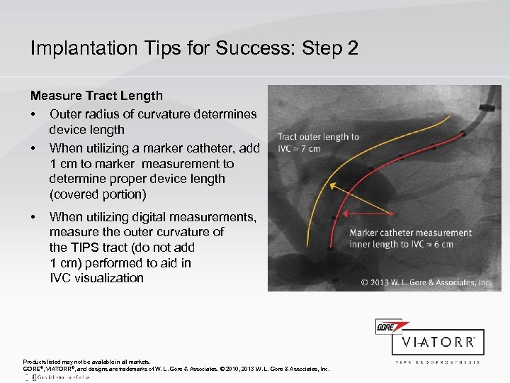 Implantation Tips for Success: Step 2 Measure Tract Length • Outer radius of curvature