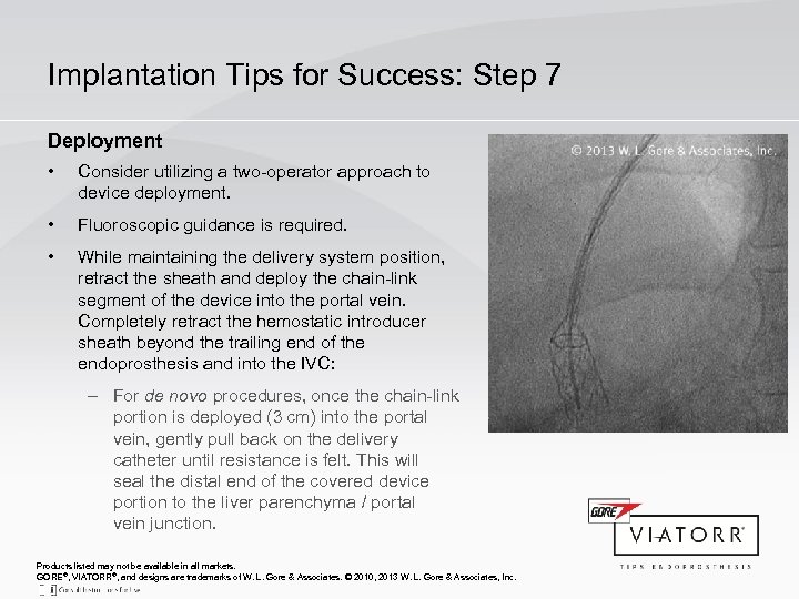 Implantation Tips for Success: Step 7 Deployment • Consider utilizing a two-operator approach to