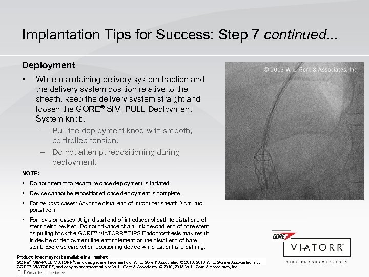 Implantation Tips for Success: Step 7 continued. . . Deployment • While maintaining delivery