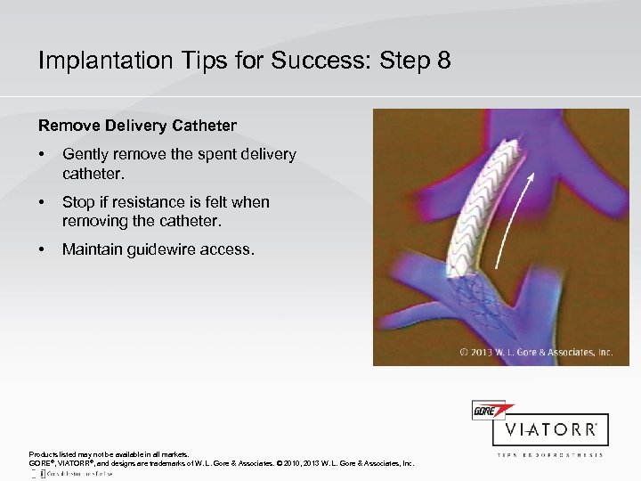 Implantation Tips for Success: Step 8 Remove Delivery Catheter • Gently remove the spent