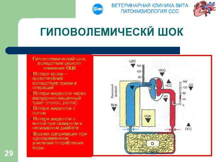 ГИПОВОЛЕМИЧЕСКЙ ШОК 29 Гиповолемический шок, вследствие резкого снижения ОЦК ØПотеря крови – кровотечение вследствие