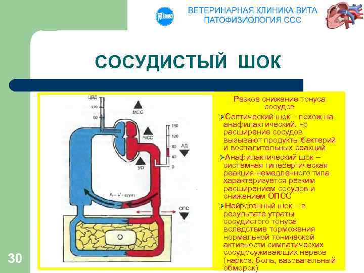 СОСУДИСТЫЙ ШОК 30 Резкое снижение тонуса сосудов ØСептический шок – похож на анафилактический, но