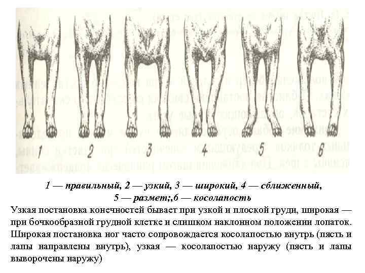 1 — правильный, 2 — узкий, 3 — широкий, 4 — сближенный, 5 —