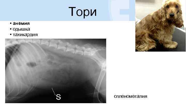 Тори • анемия • одышка • тахикардия спленомегалия 