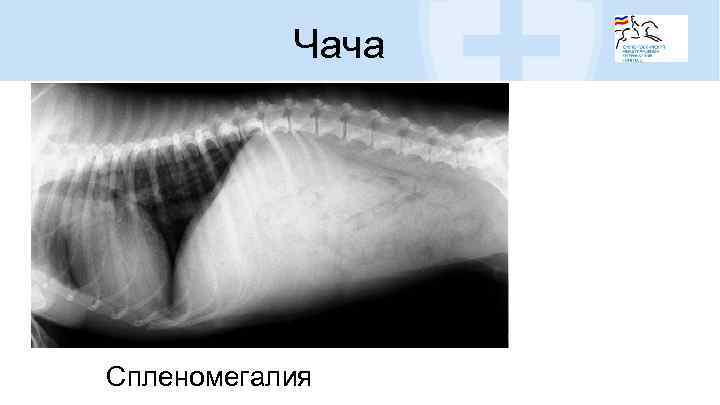 Чача Спленомегалия 