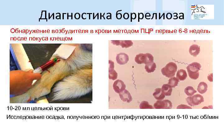 Диагностика боррелиоза Обнаружение возбудителя в крови методом ПЦР первые 6 -8 недель после покуса